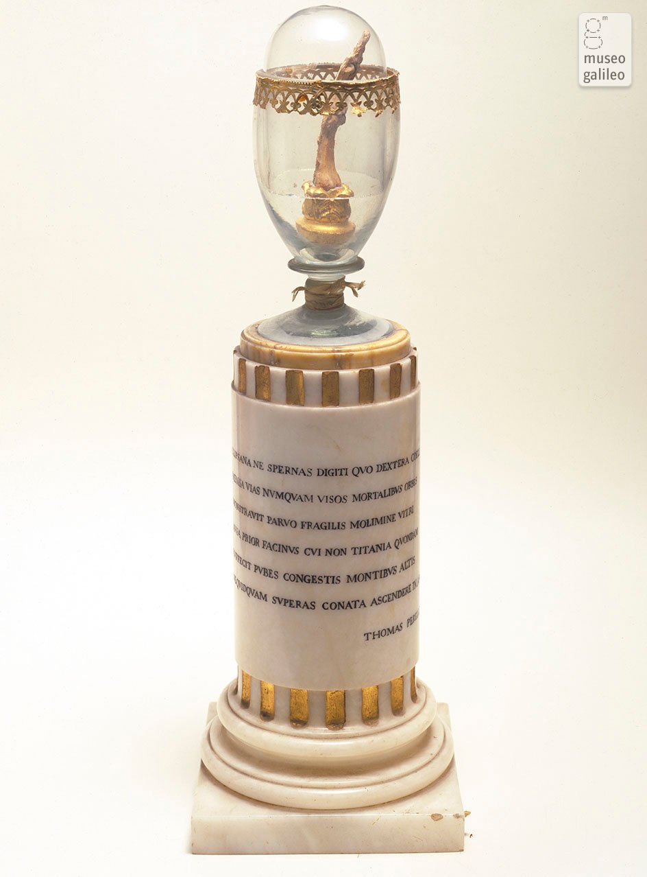 MISHI TRETET KOCKA MBETET (II)